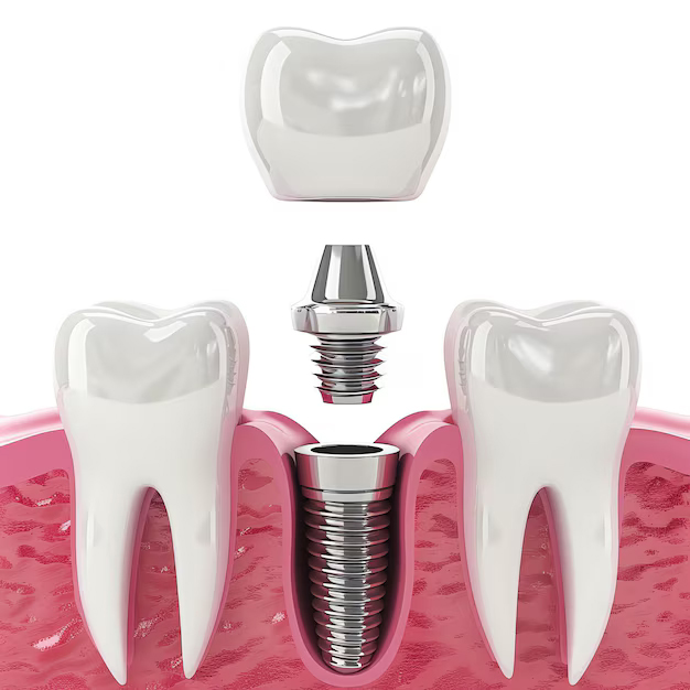 close-up-dental-tooth-implant-healthy-human-teeth-white-enamel-dental-implants-surgery_326694-124405